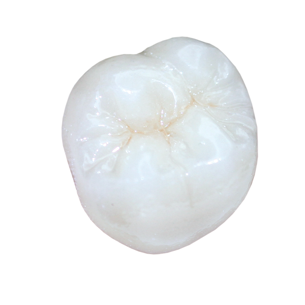 All Ceramics Digital Age Dental Laboratories